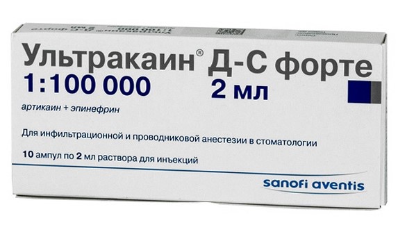 Ультракаин ДС форте, раствор 40 мг/мл+0,01 мг/мл, ампулы 2 мл, 10 шт. 
