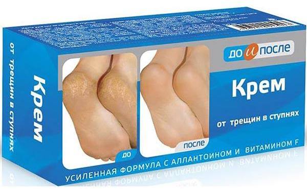 До и После, крем для ног от трещин в ступнях, 150 мл