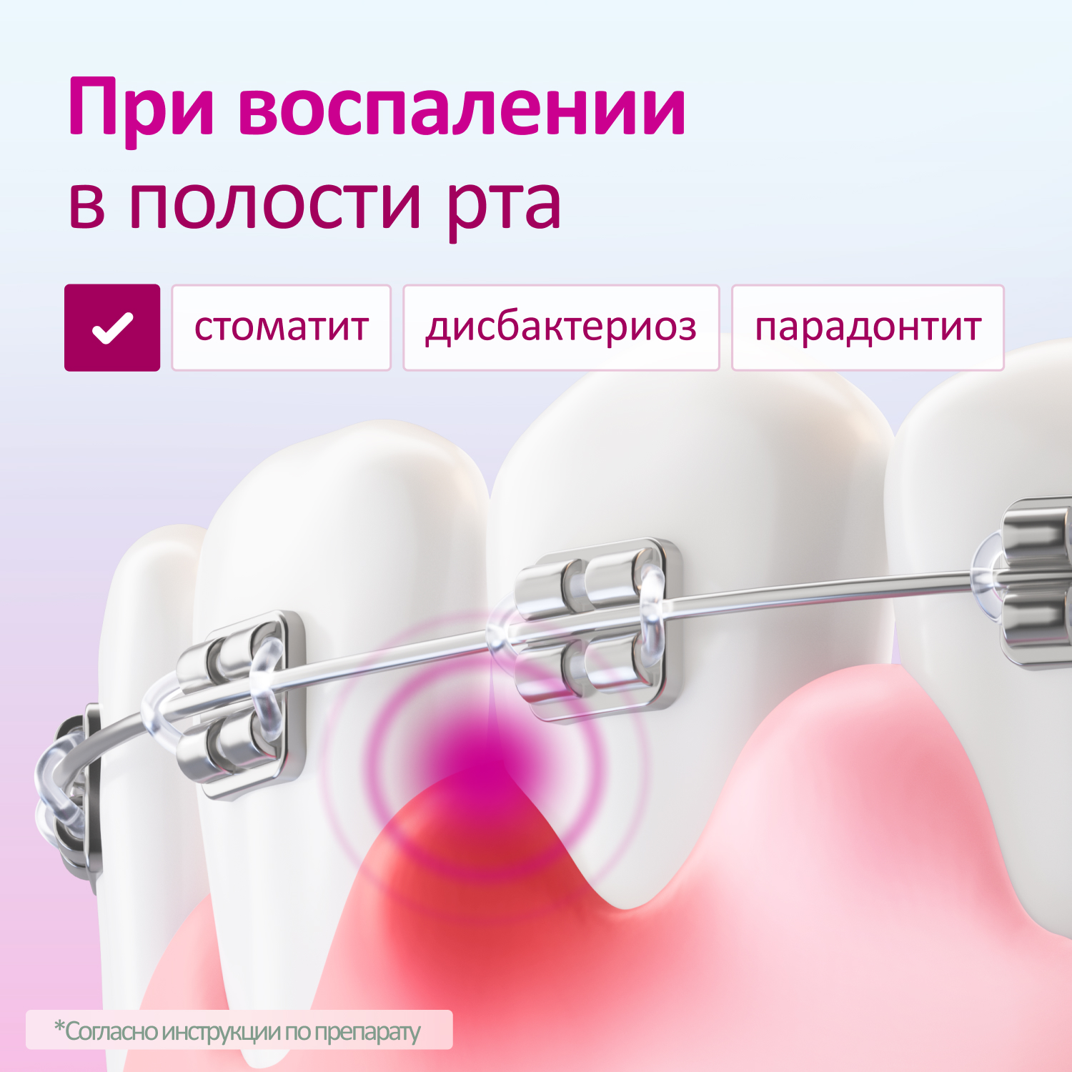 Упаковка препарата Имудон, таблетки для рассасывания, 40 шт.