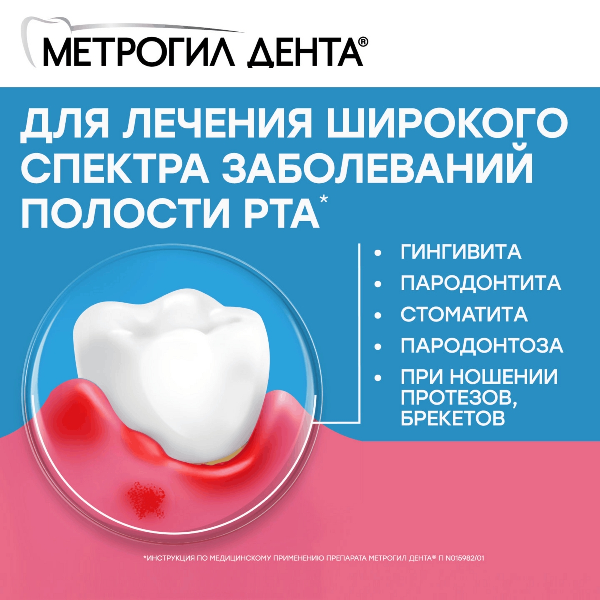 Упаковка препарата Метрогил Дента, гель стоматологический, 20 г