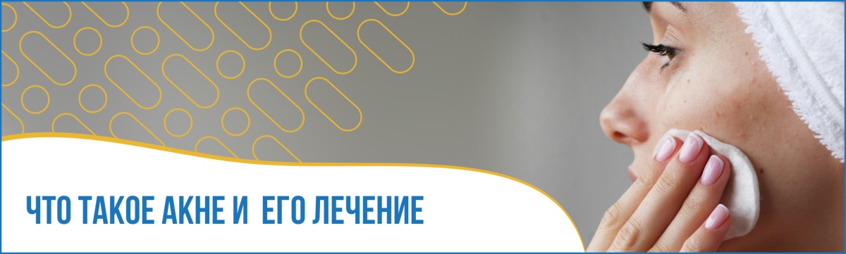 Акне и как его лечить