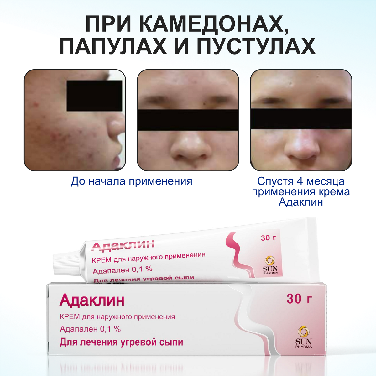 Упаковка препарата Адаклин, крем 0.1%, 30 г