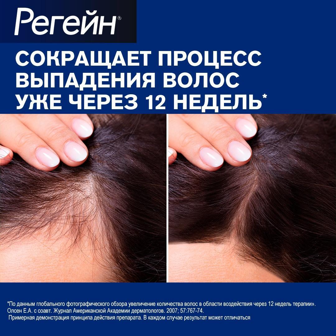 Регейн, пена 5%, 60 г, 3 шт.