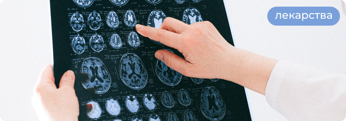 Эффективны ли ноотропы для мозга