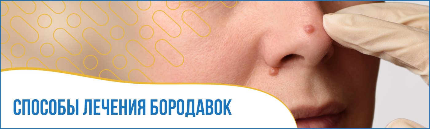 Что будет, если оторвать папиллому?