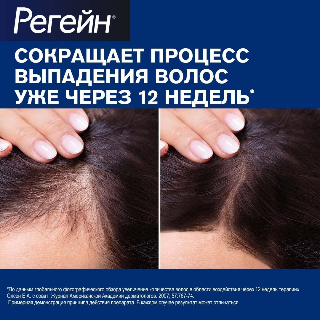 Регейн, пена 5%, 60 г, 3 шт.