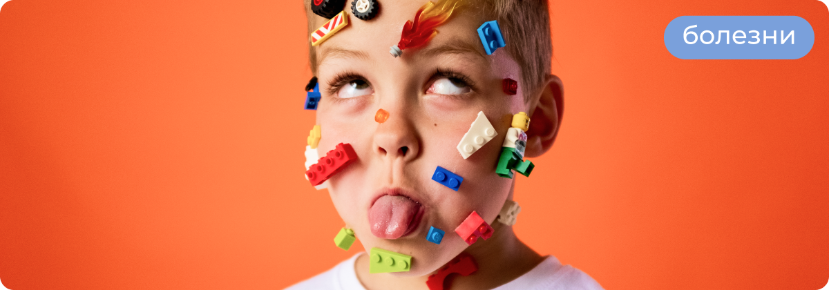 Ветрянка у ребенка: чем мазать высыпания, чтобы снять зуд и не оставить следов