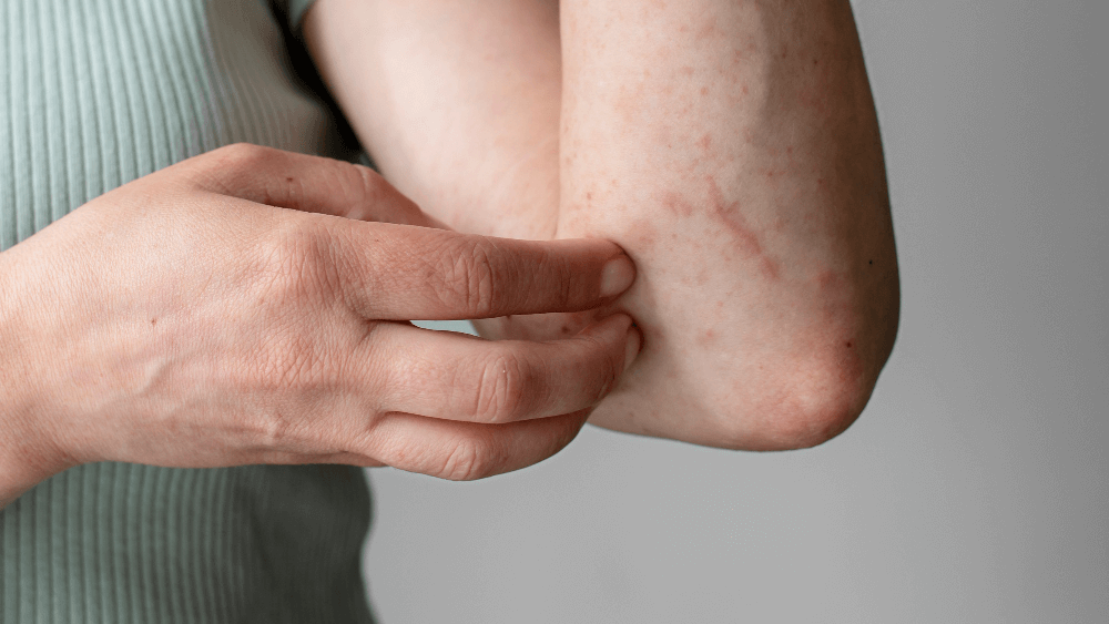 Шрам на руке