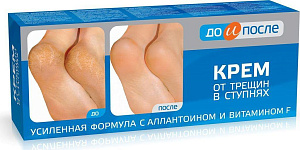 Фото Растительные компоненты