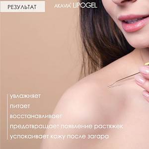 Фото Акавия