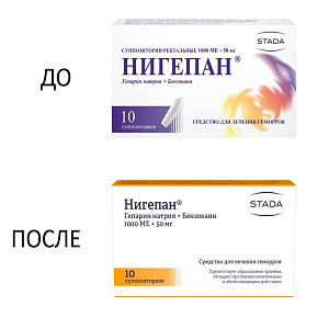 Фото Нигепан