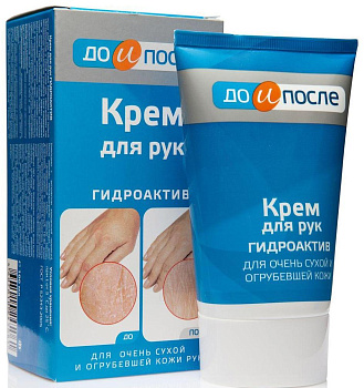 До и После Гидроактив, крем для сухой кожи рук, 100 мл