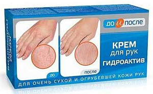 Фото До и После