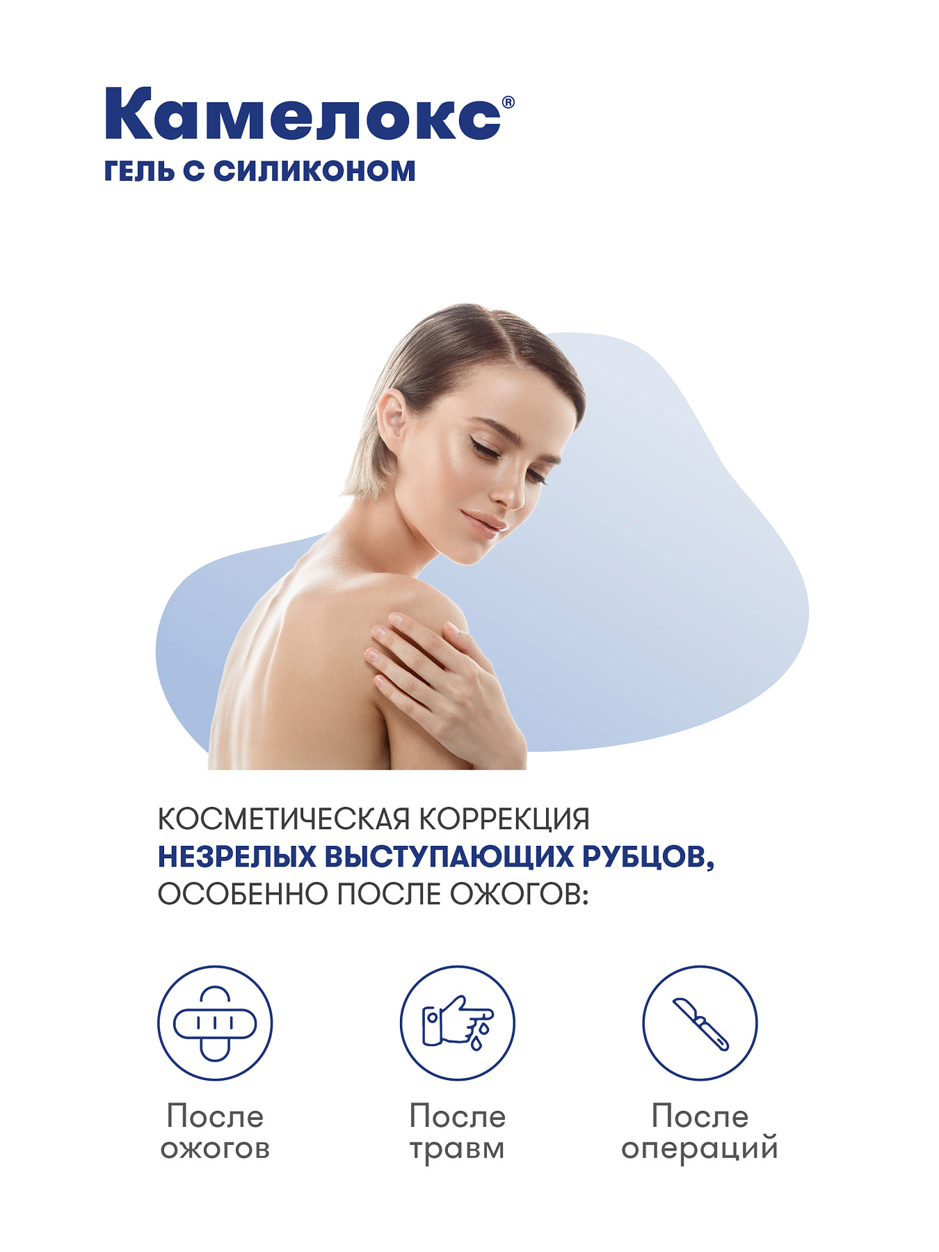 Упаковка препарата Камелокс, гель с силиконом 15 г