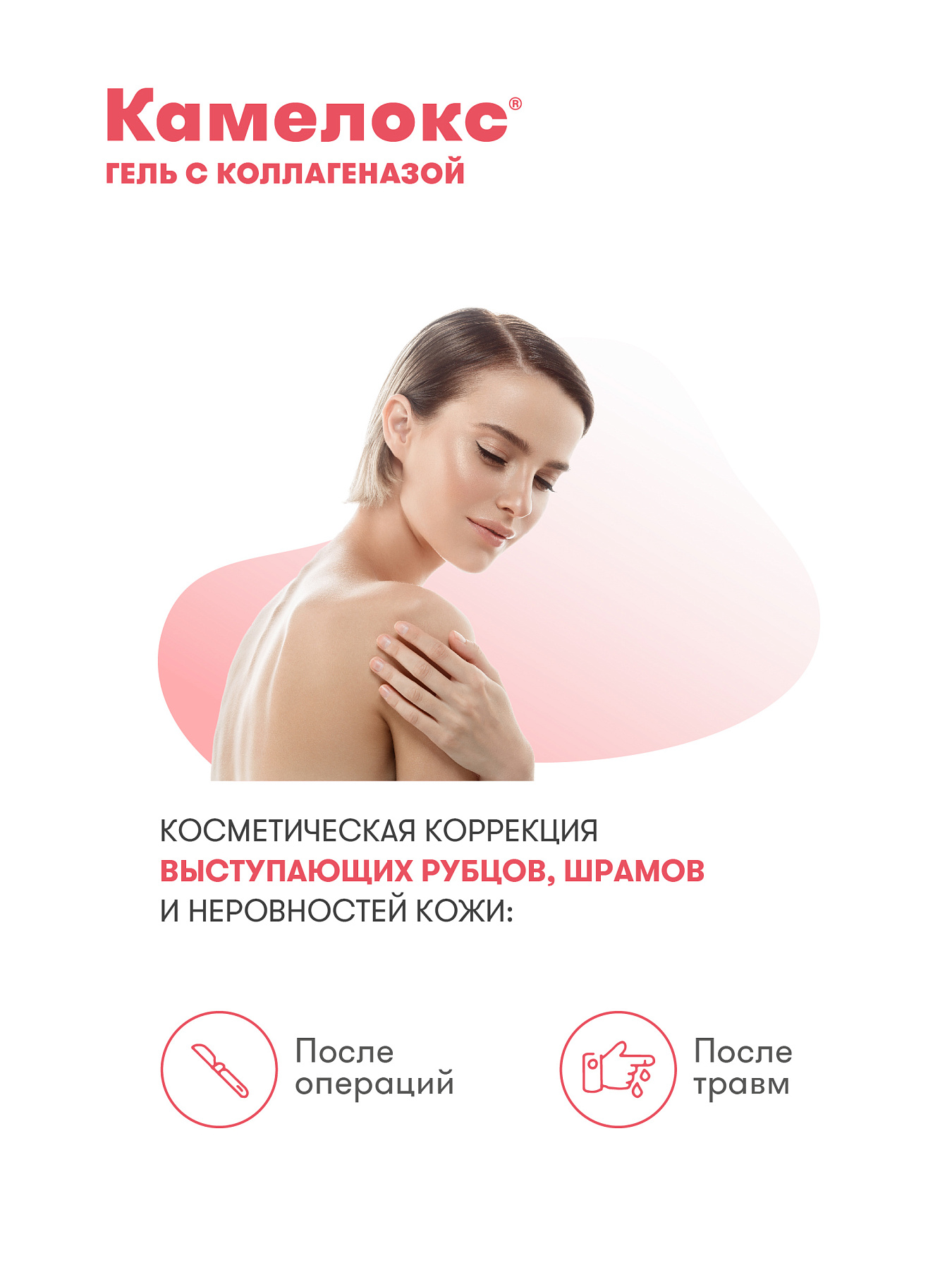 Упаковка препарата Камелокс, гель (с коллагеназой) 20 г