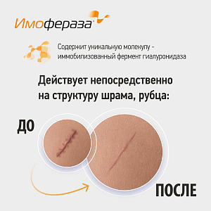 Фото Имофераза